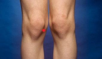 Schmerzen Innenseite Rechtes Knie Innenband Schmerzen Innenseite Rechtes Knie Innenband
