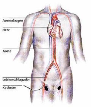 Schmerzen Leistengegend Gesundheit Medizin Muskeln Schmerzen Leistengegend Gesundheit Medizin Muskeln