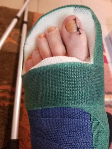 Schmerzen Nach Einer Nagelbettentzundung Im Nerv Gesundheit Und Medizin Gesundheit Arzte Schmerzen Nach Einer Nagelbettentzundung Im Nerv Gesundheit Und Medizin Gesundheit Arzte
