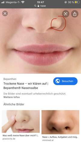 Schmerzen Nase?