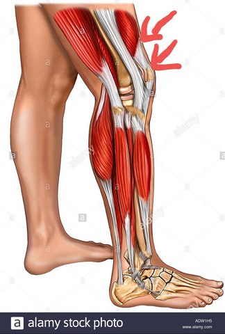 Schmerzen Oberhalb Des Knie Beim Beugen Gesundheit Und Medizin Gesundheit Sport Und Fitness Schmerzen Oberhalb Des Knie Beim Beugen Gesundheit Und Medizin Gesundheit Sport Und Fitness