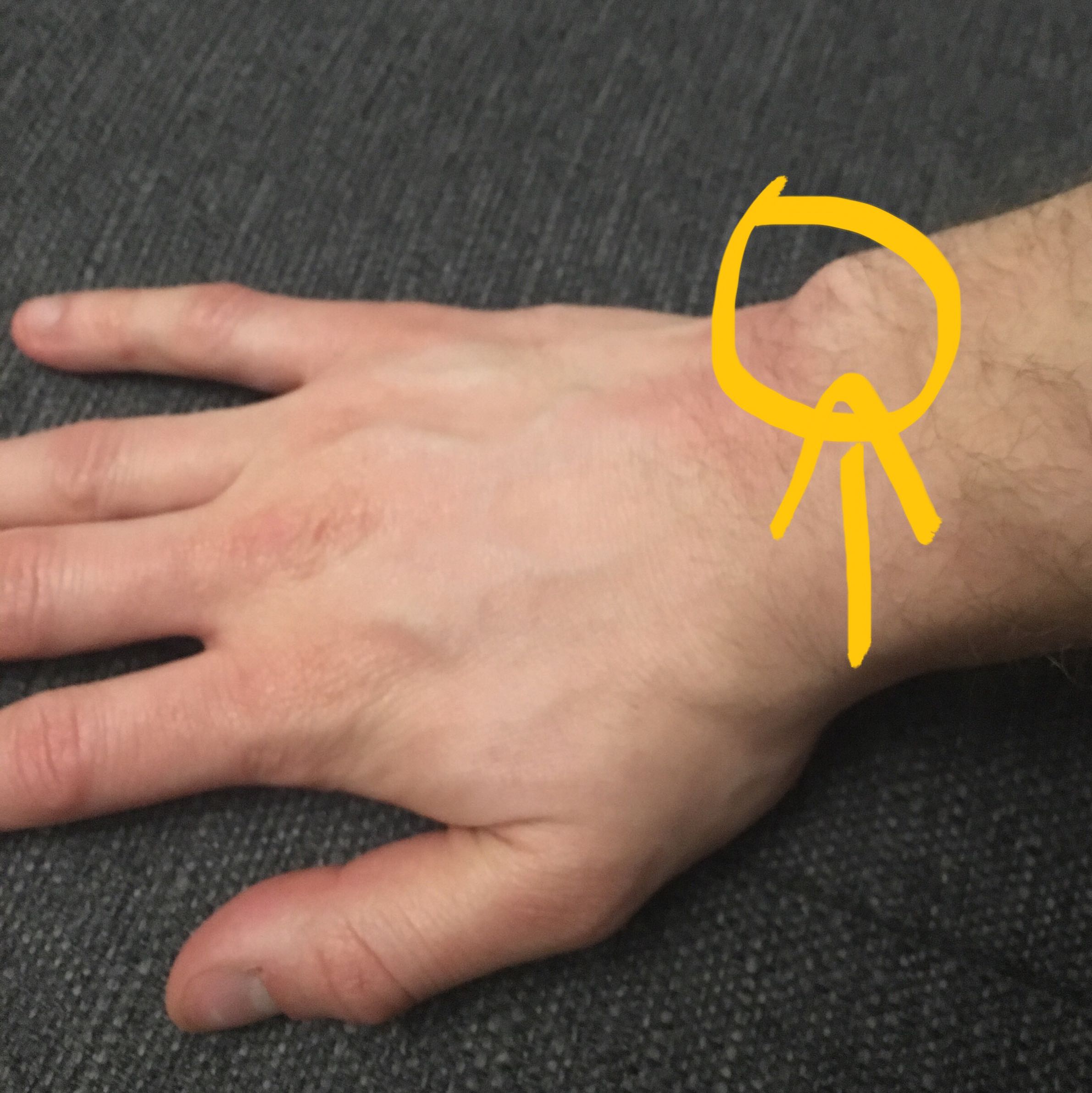 Schmerzen Oberseite Hand Hilfe? (Arzt, Handgelenk) Schmerzen Oberseite Hand Hilfe? (Arzt, Handgelenk)