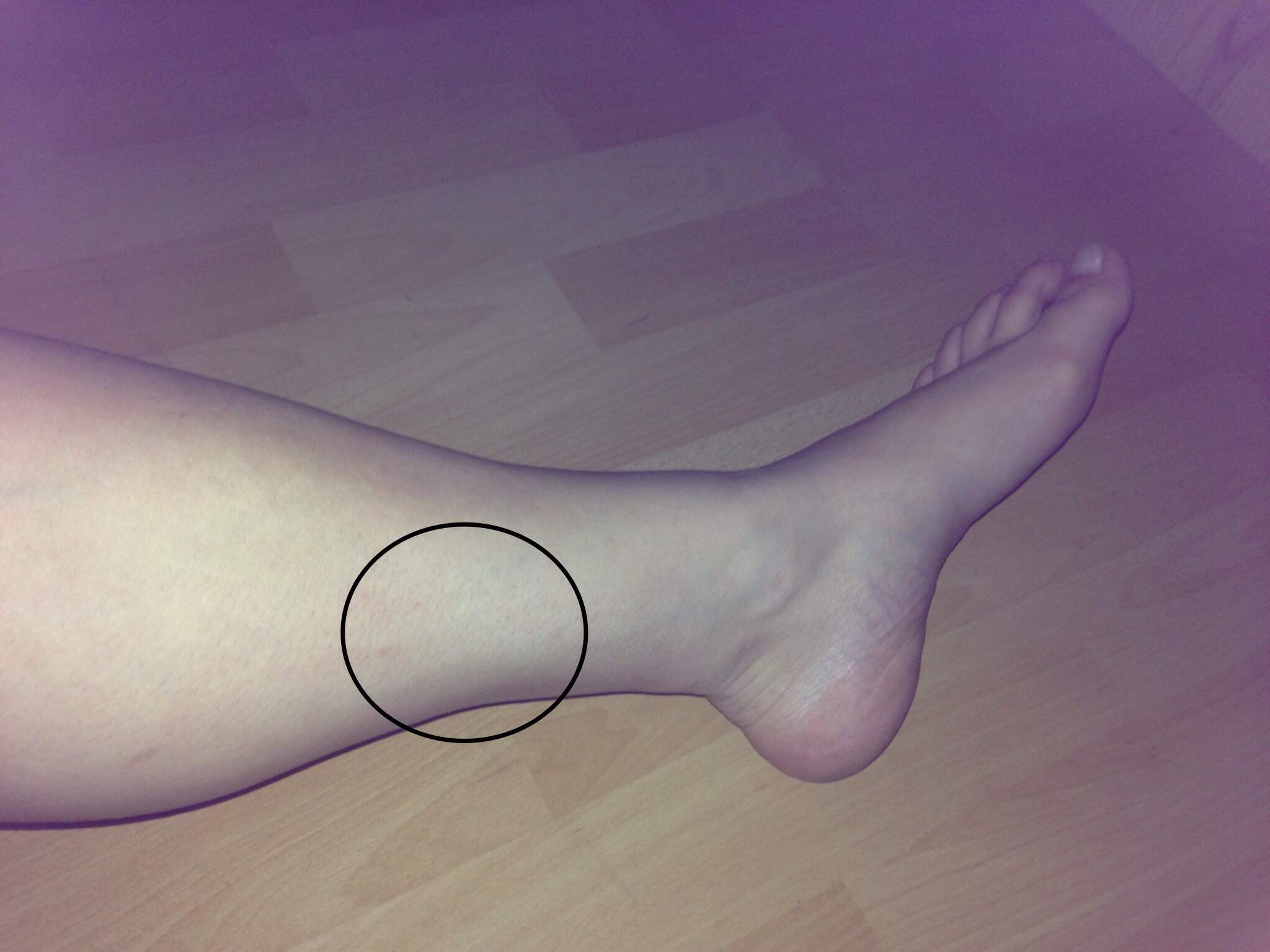 Schmerzen Stechen Wade Innen Gesundheit Beine Waden Schmerzen Stechen Wade Innen Gesundheit Beine Waden