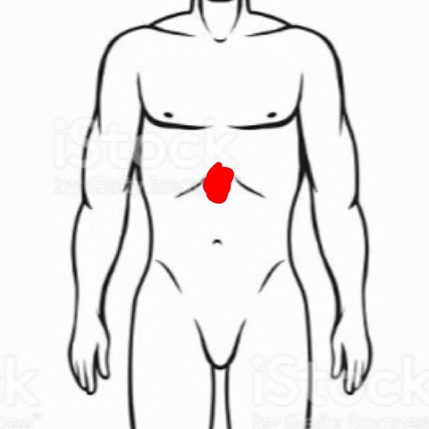 Rot markierter Bereich  - (Arzt, Schmerzen, Bauch)