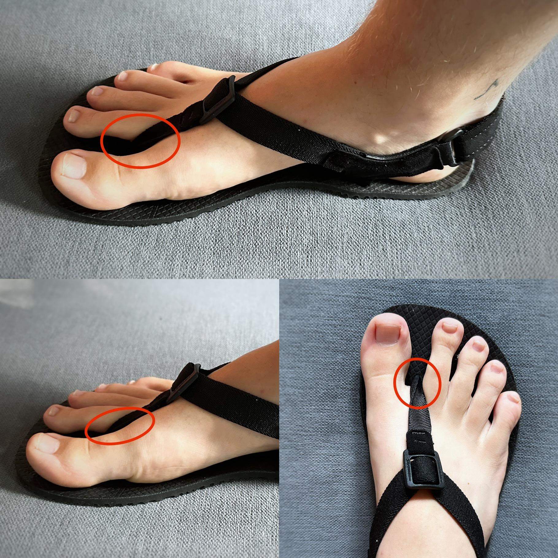 Flip Flops Scheuern Zwischen Den Zehen Schmerzen zwischen den Zehen? Barfußsandalen, Sandalen? (Schuhe, Füße
