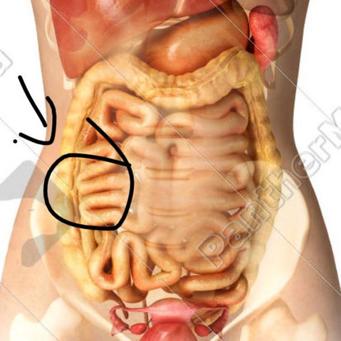 Ich weiß nicht welche Seite rechts ist haha ich habe aber die Schmerzen rechts  - (Gesundheit und Medizin, Schmerzen, Blinddarm)