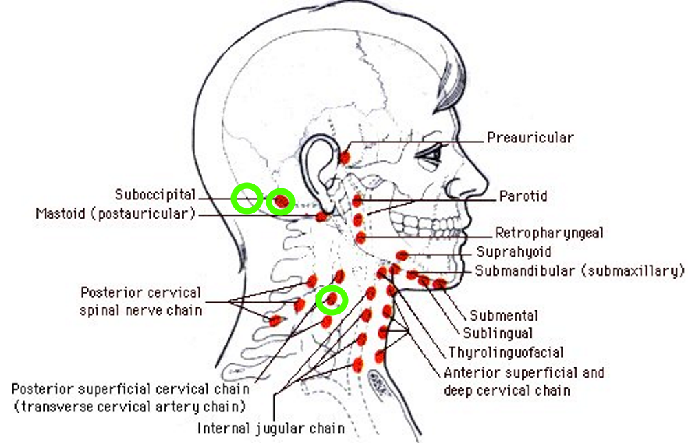 Schmerzende Beulen am Kopf Lymphknoten sind die Schmerzende Beulen am Kopf Lymphknoten sind die