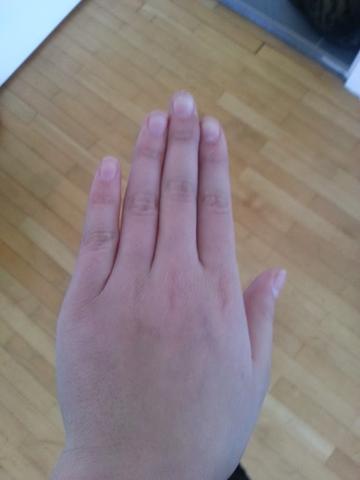 Unverletzte Hand - (Medizin, Körper, Kochen)