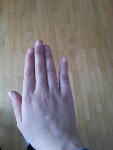 Hier mein verletzter, kleiner Finger - (Medizin, Körper, Kochen)