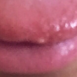 34+ Pickel Auf Der Zunge Bilder Gif