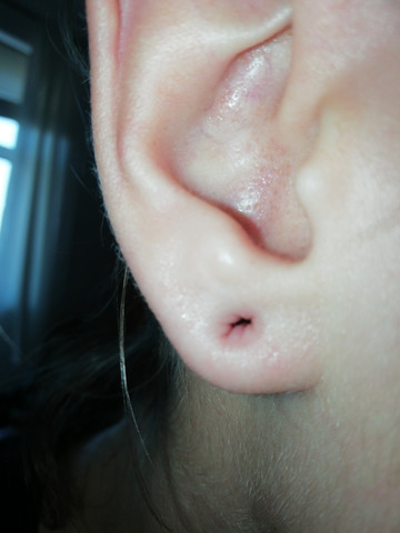 Featured image of post Großes Ohrloch / Ich möchte mein ohrloch von 3.5 mm auf 5 mm dehnen.