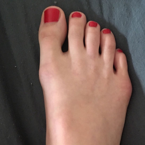 Fuß rechts  - (Gesundheit und Medizin, Operation, Chirurgie)