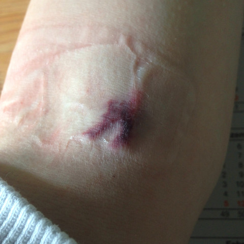 Ehm ja.... Geschwollen ists auch - (Arzt, Krankenhaus, Blut)