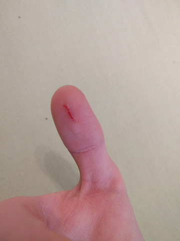 Schnittwunde Am Daumen Blutet Gesundheit Und Medizin Arzt Wunde Schnittwunde Am Daumen Blutet Gesundheit Und Medizin Arzt Wunde