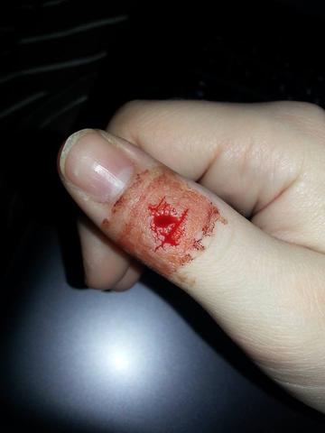 Schnittwunde Zum Arzt Gesundheit Medizin Krankenhaus Schnittwunde Zum Arzt Gesundheit Medizin Krankenhaus