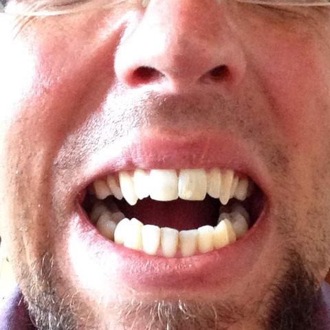 Hier ein Bild von meinen Zähnen - nichts geändert mit Bildbearbeitung - (Beauty, Zähne)