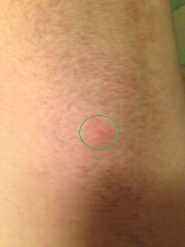 zeit schmerzempfindlicher punkt