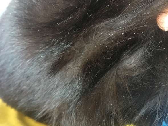 schuppen bei meinem kater katze