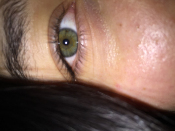Schuppige Haut Unter Dem Auge Gesundheit Und Medizin Beauty Augen Schuppige Haut Unter Dem Auge Gesundheit Und Medizin Beauty Augen