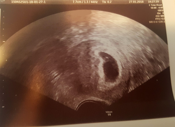 7 Monat Welche Woche Captions Beautiful 7 Monat Welche Woche Captions Beautiful