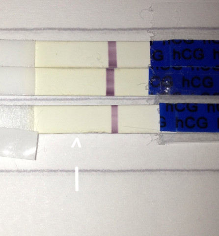 Negativ falsch ss test ES+13/14 SSW