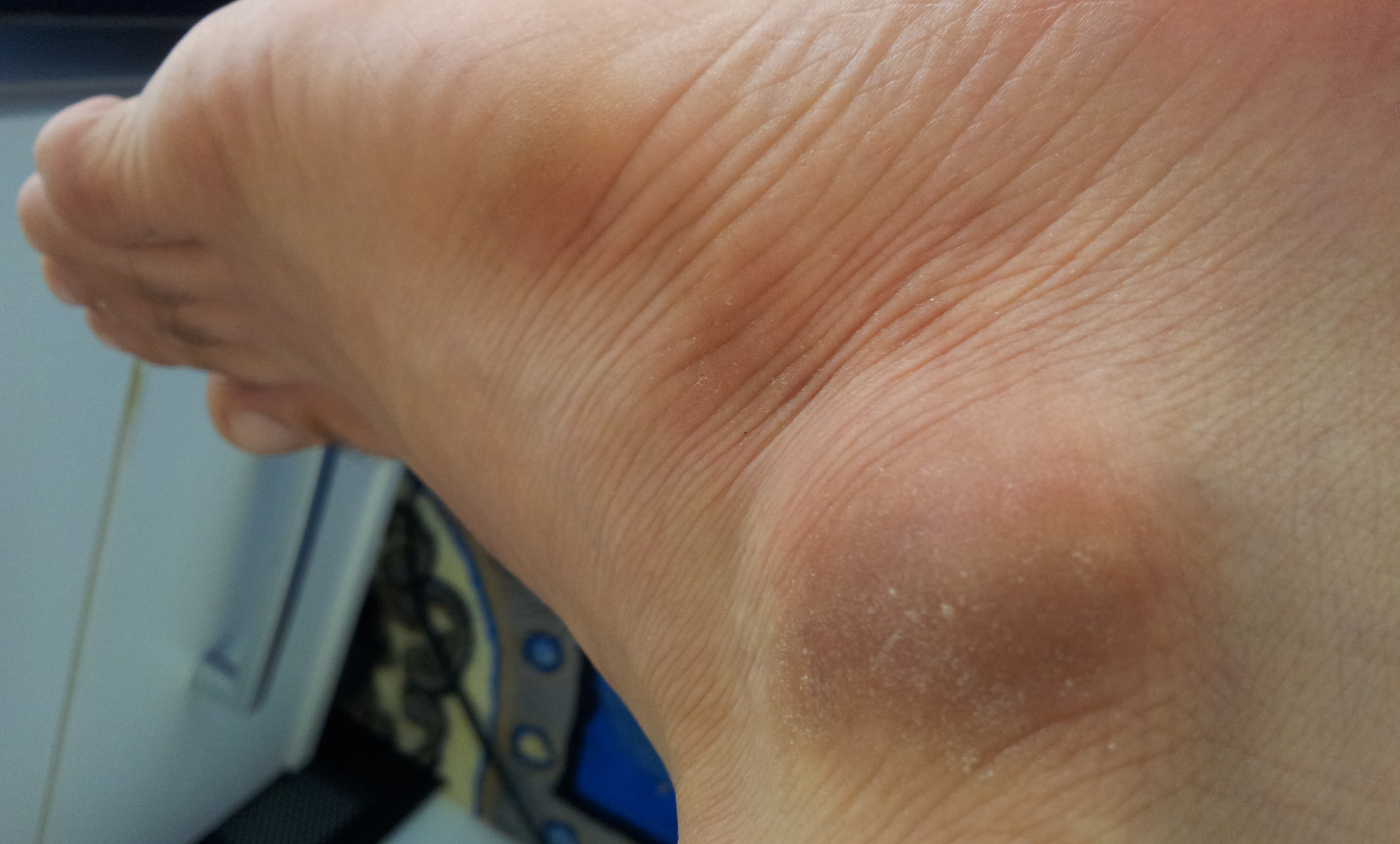 schwarz am knöchel? (Arzt, danke, Diagnose)