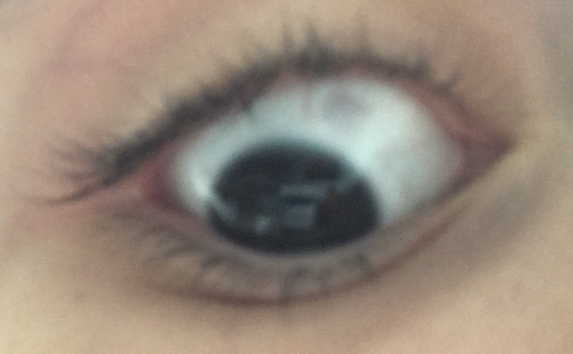Schwarz Grauer Punkt Im Auge Augen Punkte Schwarz Grauer Punkt Im Auge Augen Punkte