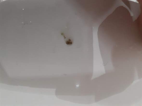 Schwarz Brauner Auswurf Nach Kiff Rauchende Gesundheit Und Medizin Gesundheit Rauchen Schwarz Brauner Auswurf Nach Kiff Rauchende Gesundheit Und Medizin Gesundheit Rauchen