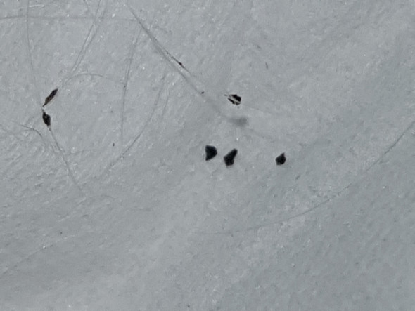 Schwarze Punkte Im Fell Katze Flohe Fellpflege