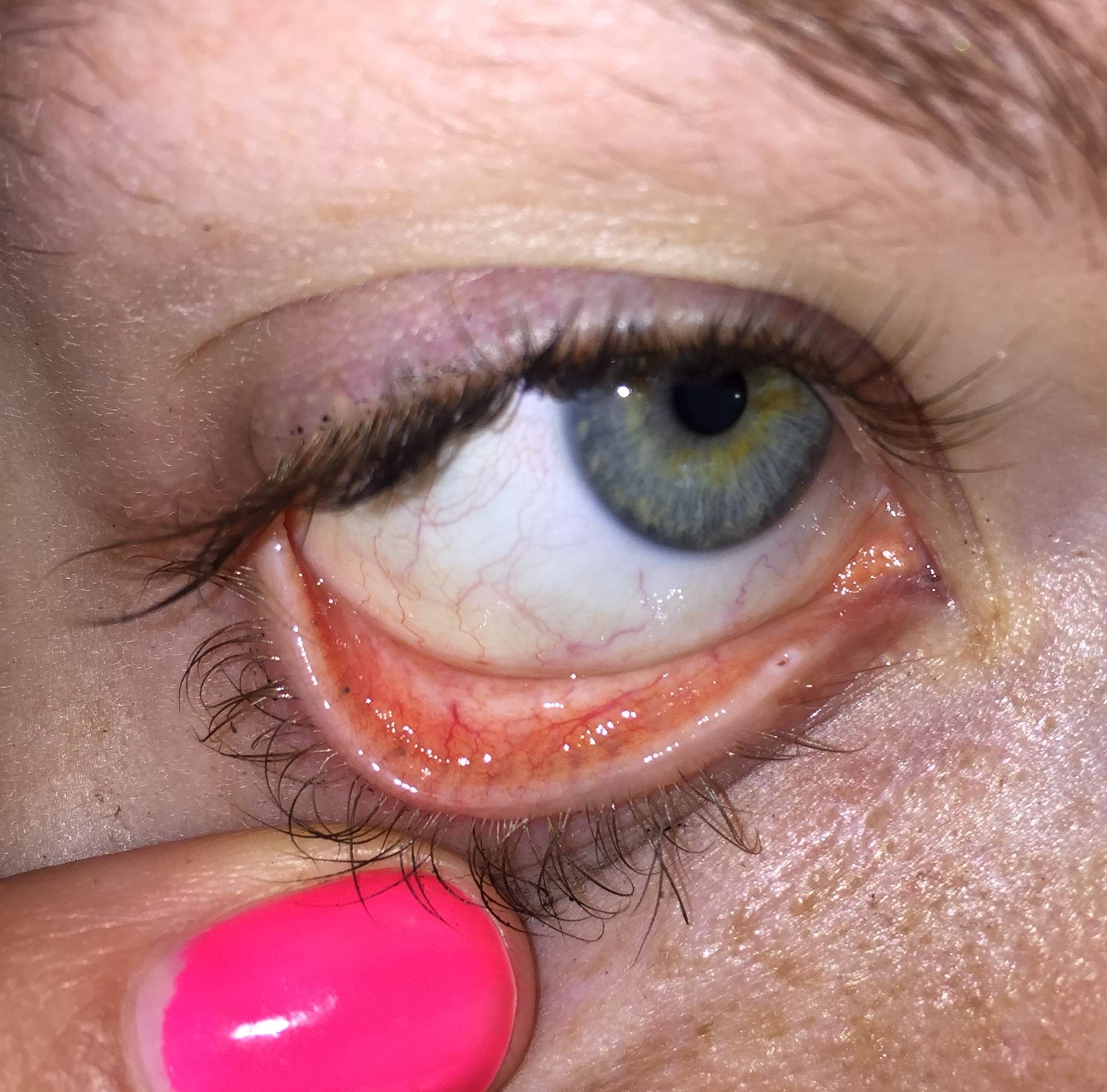 schwarze Punkte im inneren Augenlid? schwarze Punkte im inneren Augenlid?