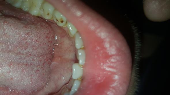 Schwarze Punkte - (Zähne, Frisur, Zahnarzt)