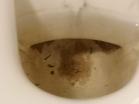 Schwarze Würmer in Toilette?