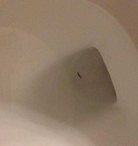 Schwarzer Kleiner Wurm Toilette Gesundheit Und Medizin Panik Urin Schwarzer Kleiner Wurm Toilette Gesundheit Und Medizin Panik Urin