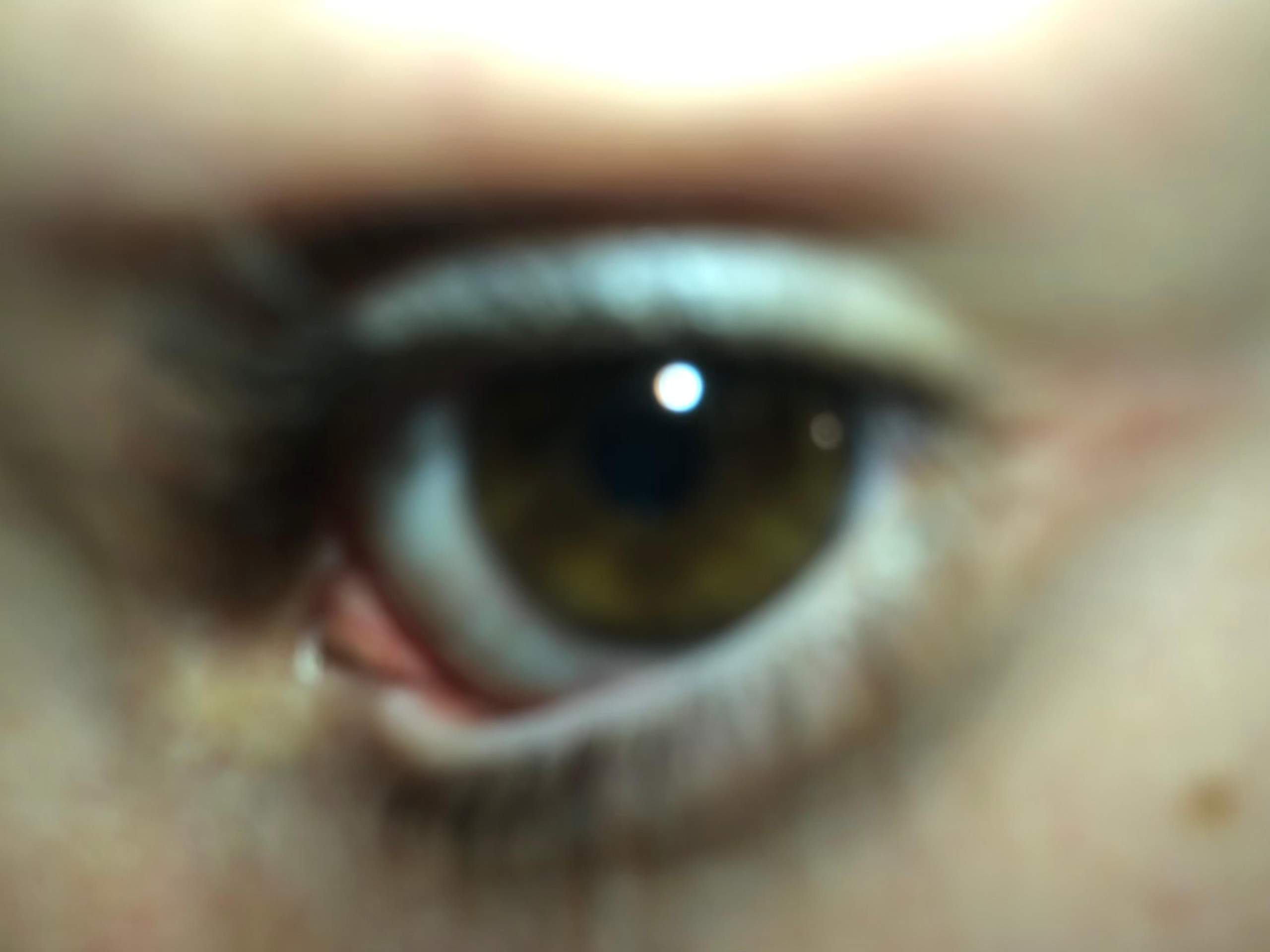 Schwarzer Punkt im Augenwinkel/Tränensack Hilfe? (Gesundheit und Medizin, Augen) Schwarzer Punkt im Augenwinkel/Tränensack Hilfe? (Gesundheit und Medizin, Augen)