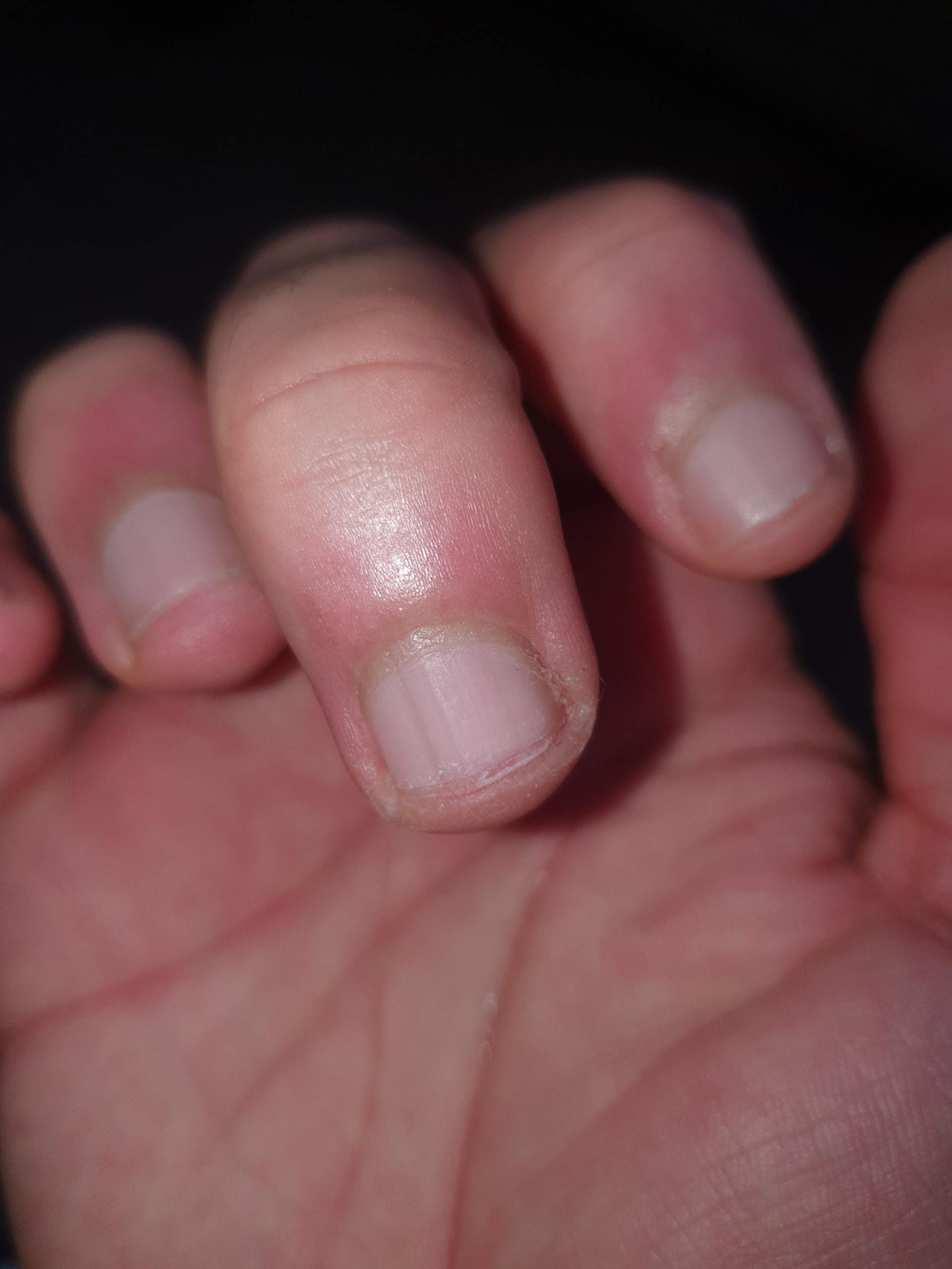schwarzer streifen nagel computer nagel fingernagel