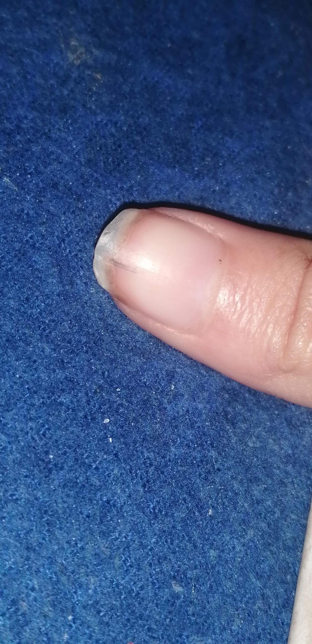 Schwarzer Strich unterm Nagel? (Nägel)