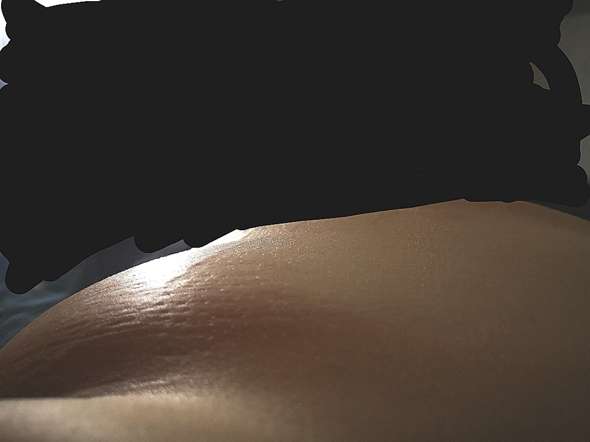 Schwellung Direkt Unter Der Linken Brust Gesundheit Und Medizin Schmerzen Schwellung Direkt Unter Der Linken Brust Gesundheit Und Medizin Schmerzen