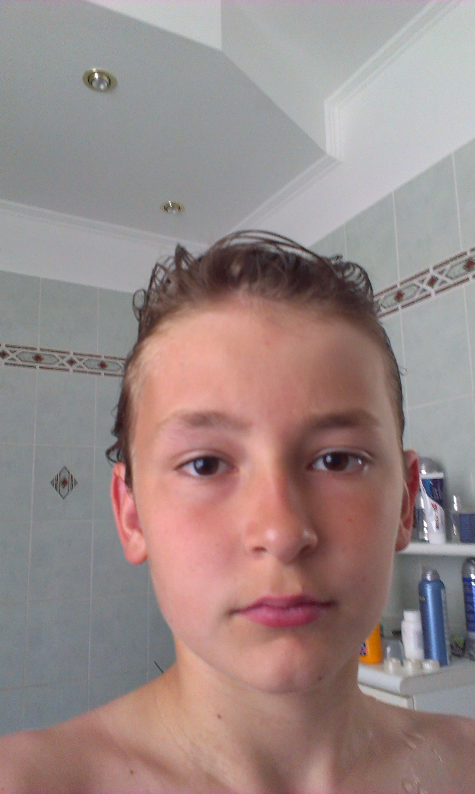 segelohren was tun ohne op