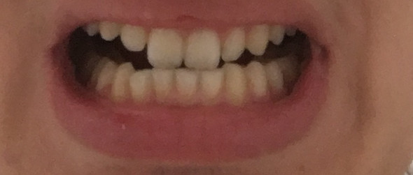 2/2 - (Zähne, Zahnarzt, Kiefer)