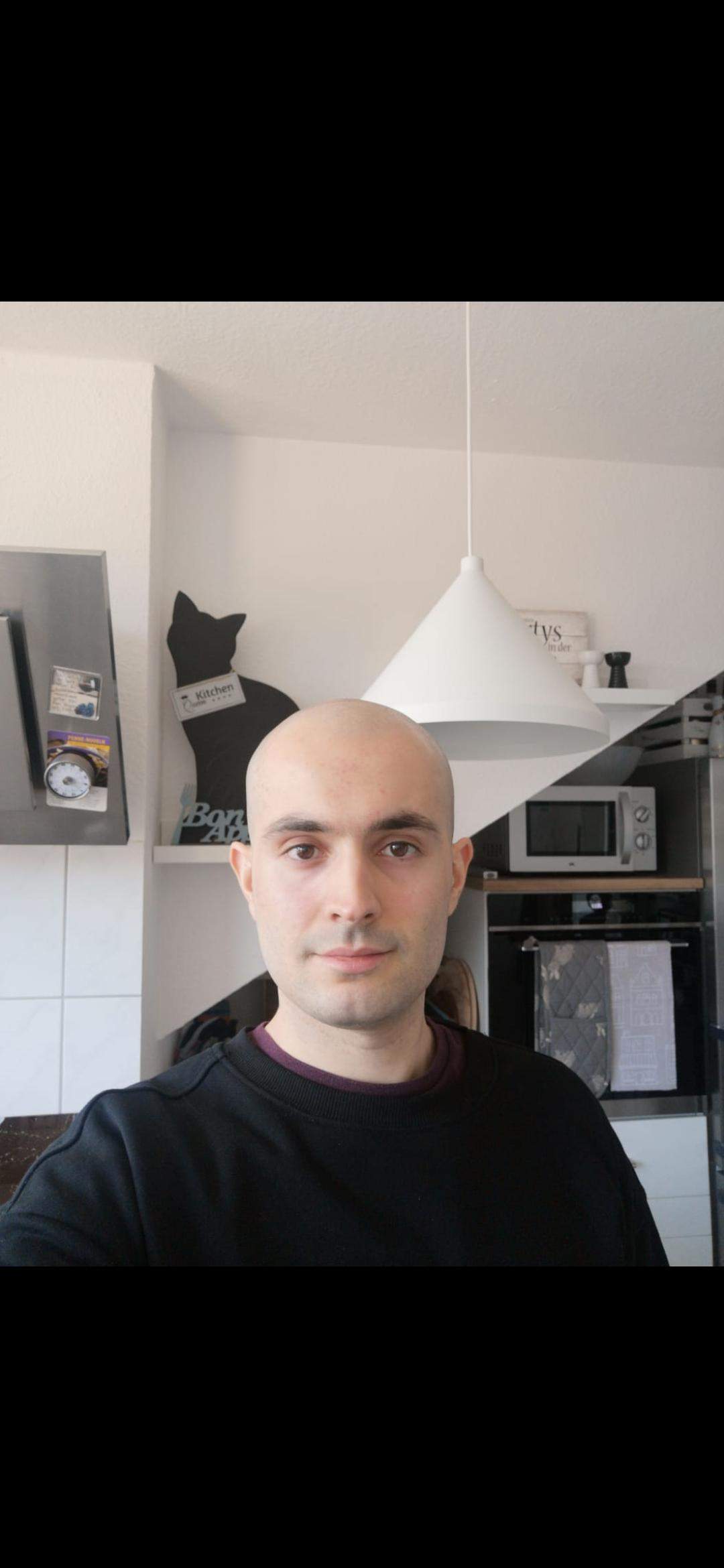 Sehe ich mit der Glatze älter als sonst aus? (Männer, Aussehen, Friseur)
