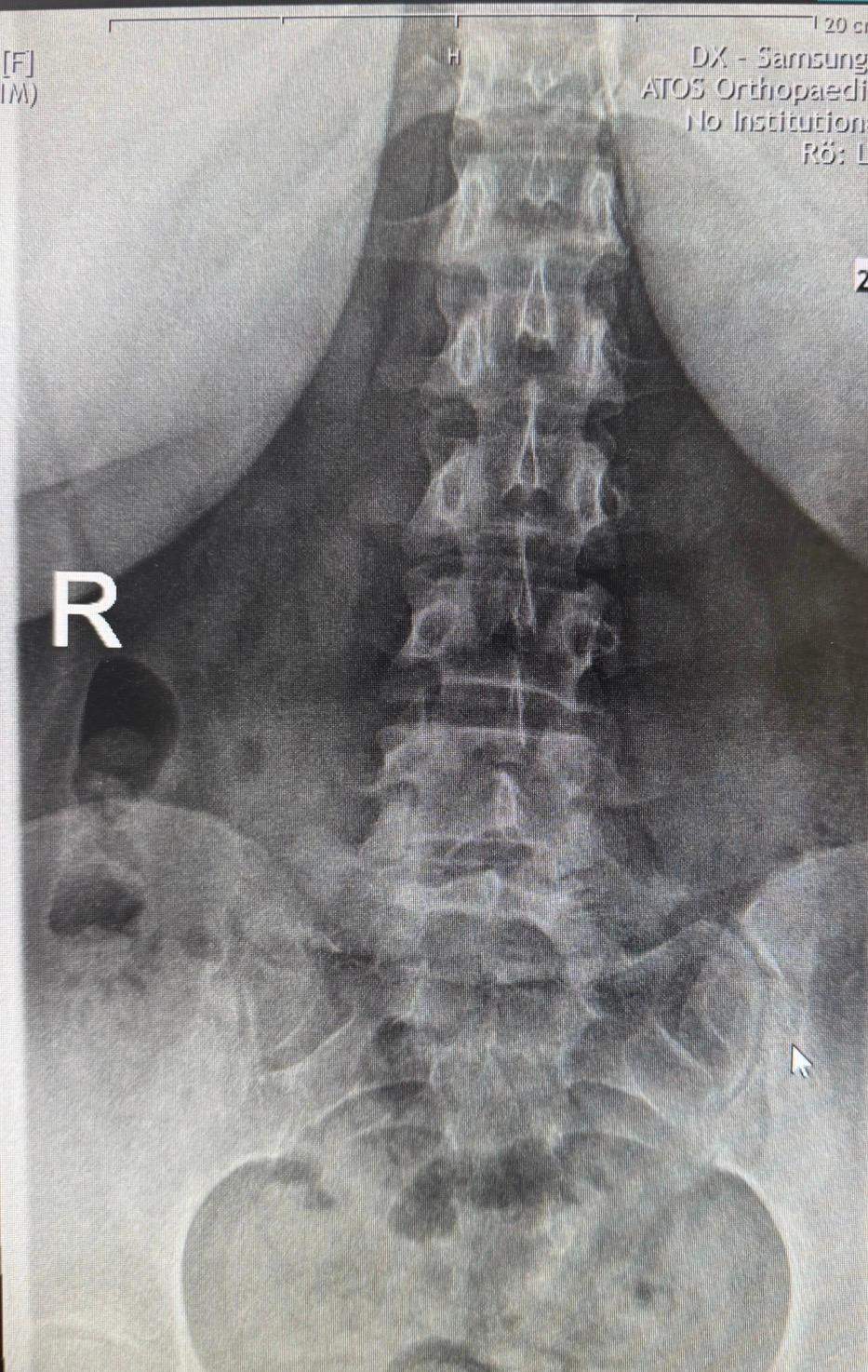 Sehen die Röntgenbilder normal aus?? (Schmerzen, Orthopäde, Orthopädie)