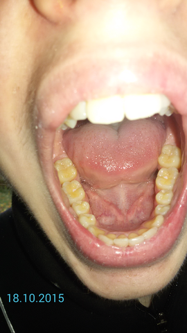 Sind diese Zähne schlecht? - (Gesundheit, Körper, Zähne)