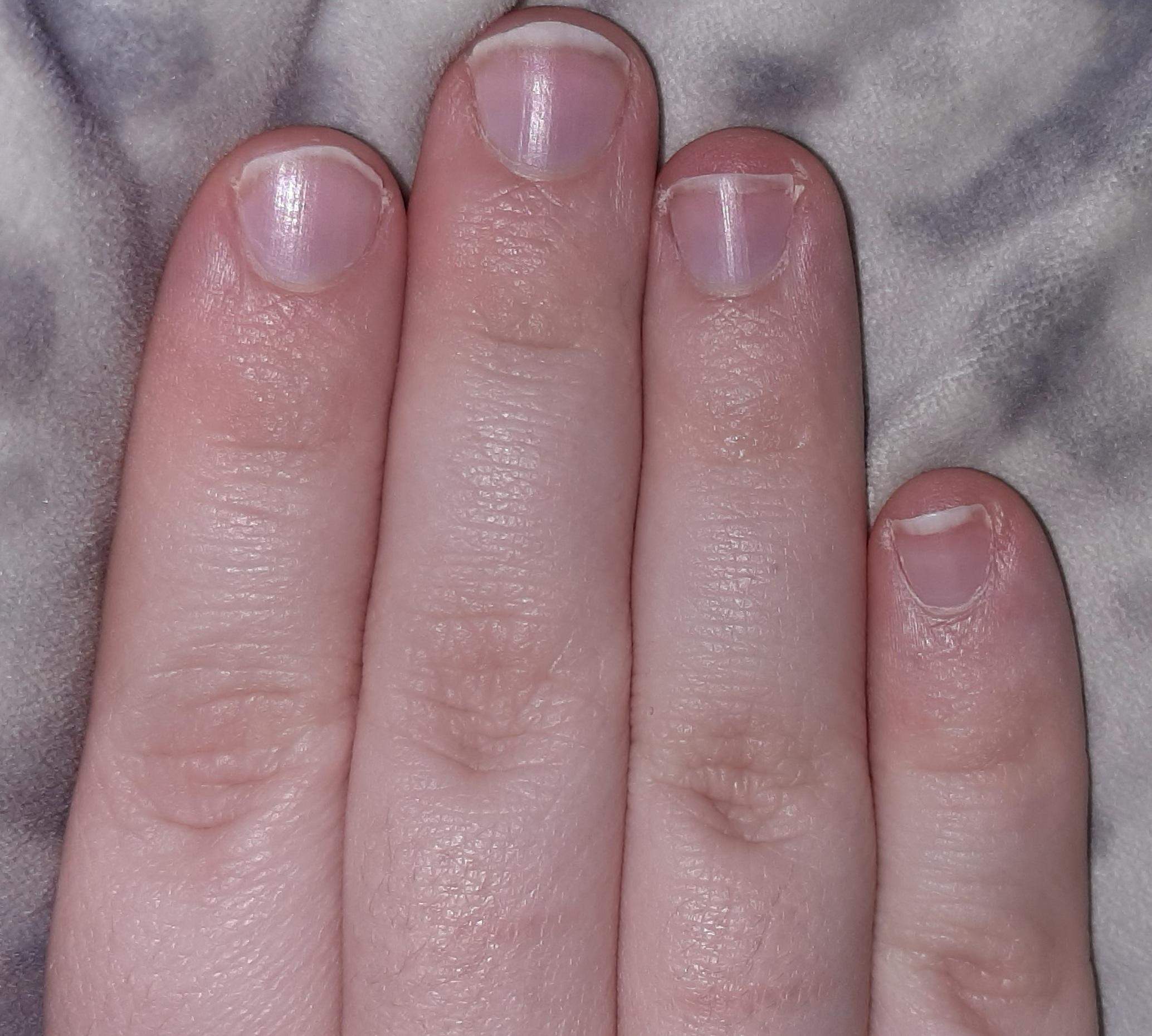Wurstfinger: Diese Ringe lassen deine Finger schmaler wirken als sie sind -  wmn