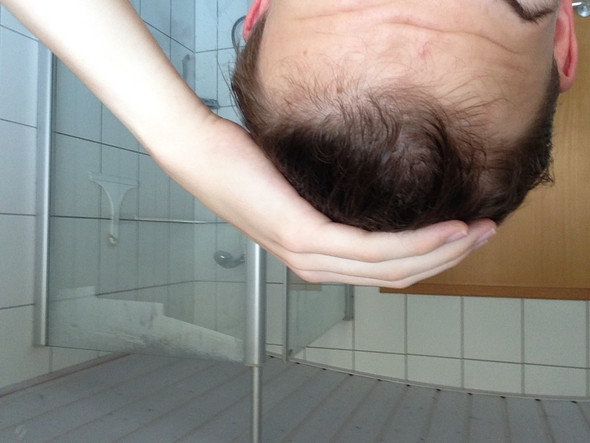 sehr dunne haare kaum noch haare mit