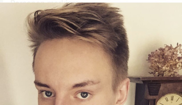 Sehr Hohe Stirn Wie Am Besten Retuschieren Korper Beauty Mode