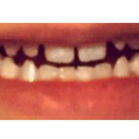 Meine Zähne - (Zähne, Zahnarzt, klein)