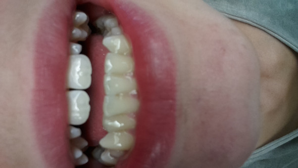 Meine Zähne - (Zähne, Spitze)