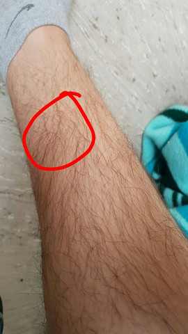 Sehr Starke Schmerzen Am Schienbein Was Tun Gesundheit Leben Sehr Starke Schmerzen Am Schienbein Was Tun Gesundheit Leben