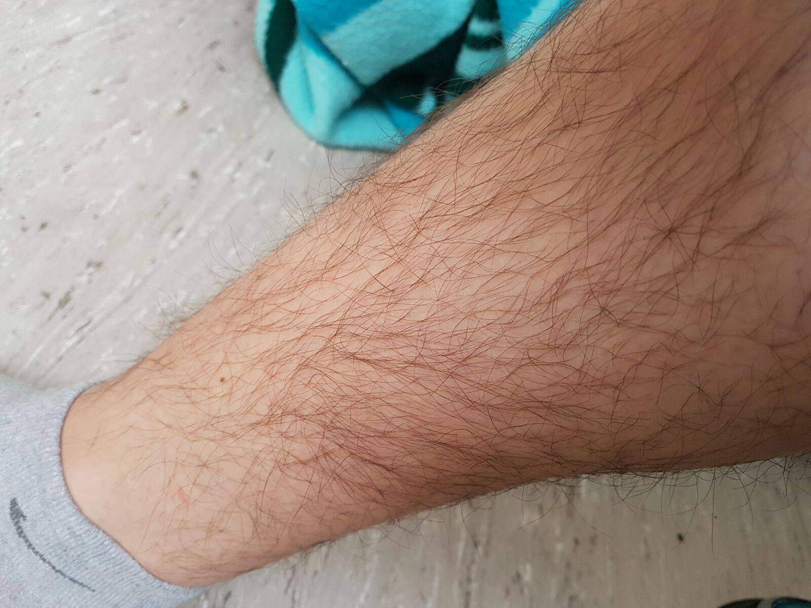 Sehr starke Schmerzen am Schienbein was tun? (Gesundheit, Leben) Sehr starke Schmerzen am Schienbein was tun? (Gesundheit, Leben)