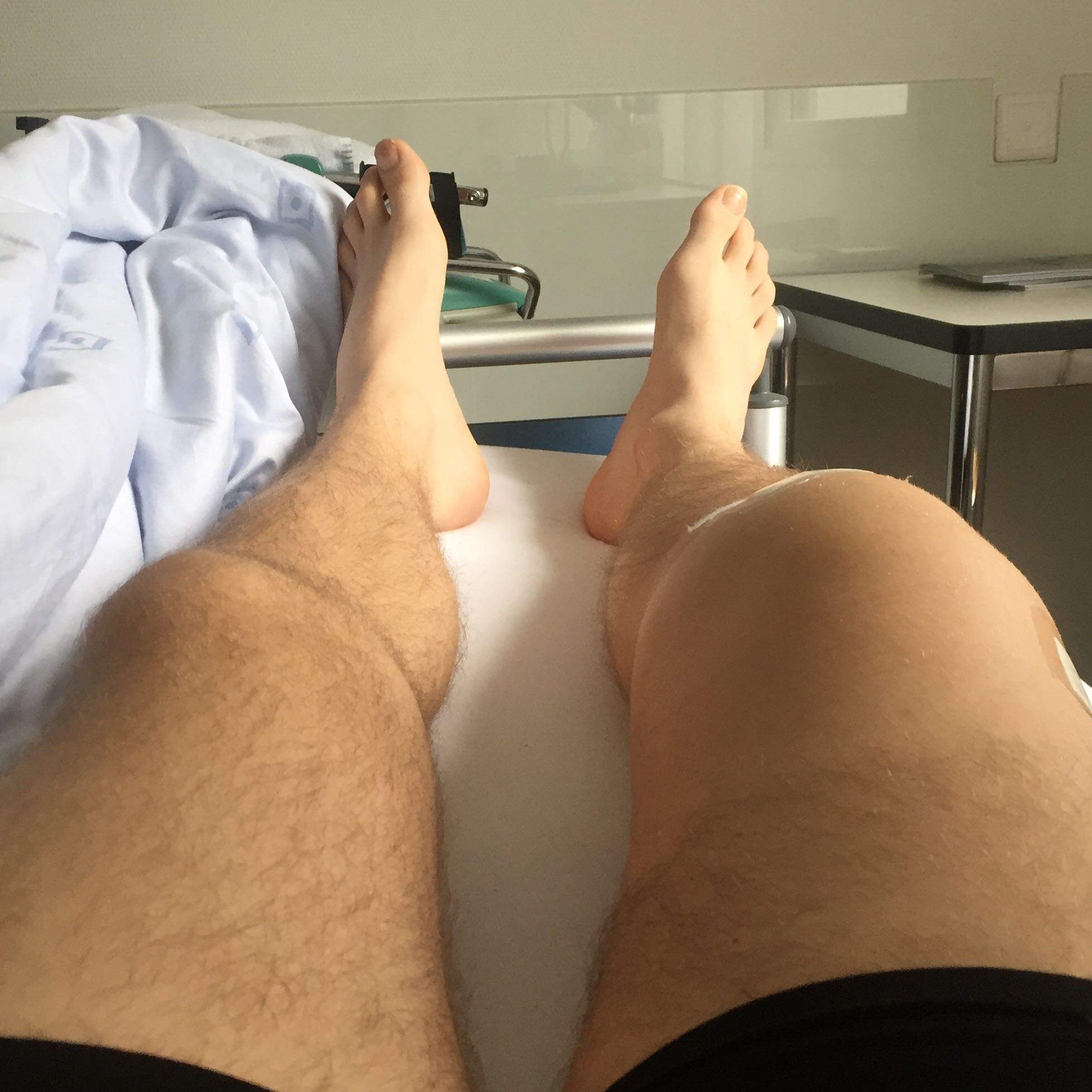 Sehr Starke Schmerzen Und Extreme Schwellung Nach Kreuzband Meniskus Op Sehr Starke Schmerzen Und Extreme Schwellung Nach Kreuzband Meniskus Op